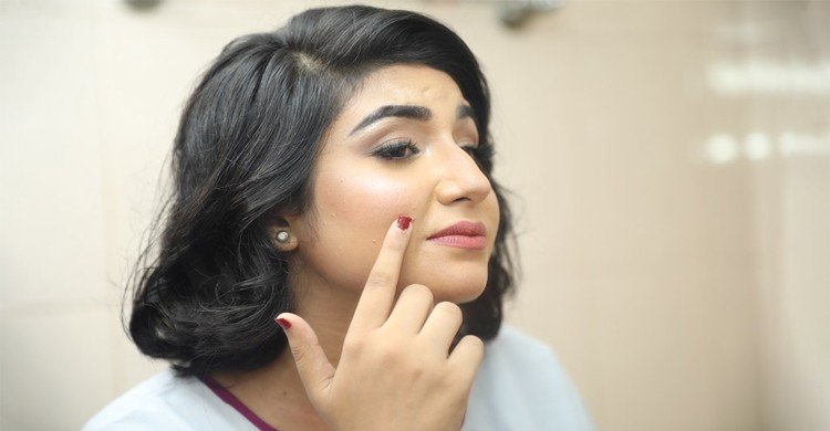 মধ্যবয়সে কেন ব্রণ হয়? করণীয় ও চিকিৎসা কী?