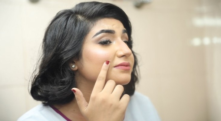 মধ্যবয়সে কেন ব্রণ হয়? করণীয় ও চিকিৎসা কী?