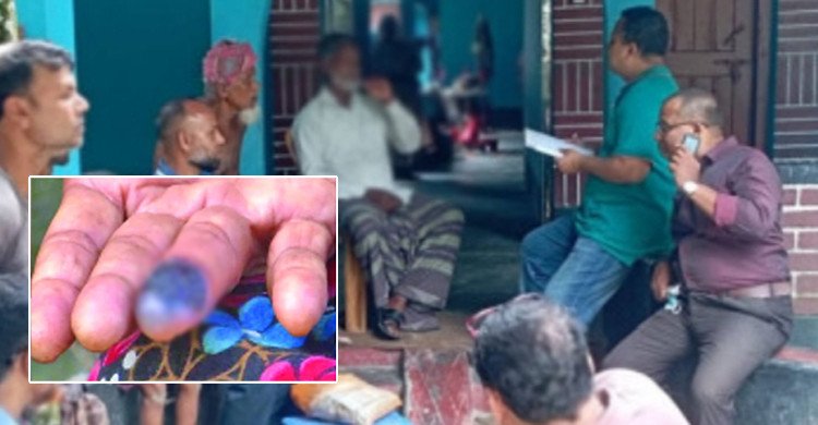 রংপুরের কাউনিয়ায় আরও দুইজন অ্যানথ্রাক্সে আক্রান্ত রোগী শনাক্ত