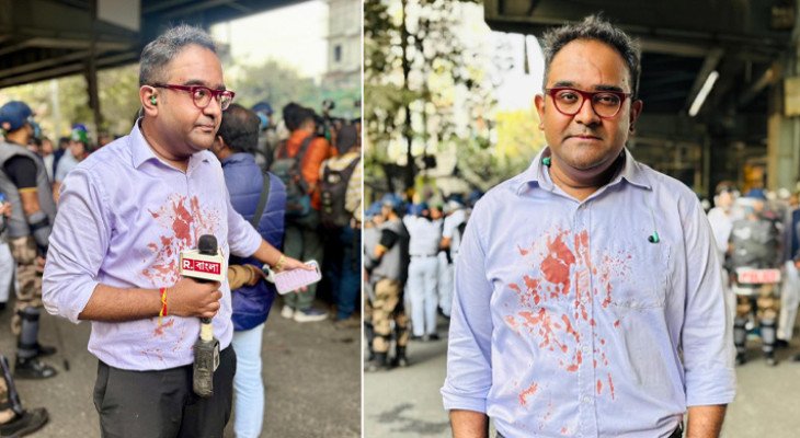কলকাতায় বাংলাদেশবিরোধী বিক্ষোভে সংঘর্ষ, রক্তাক্ত ময়ূখ রঞ্জন