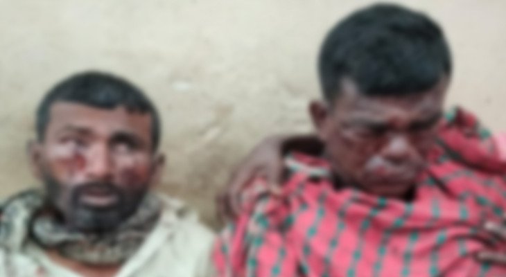 মাটির নিচে পুঁতে রাখা বোমা বিস্ফোরণে দুই শ্রমিক আহত