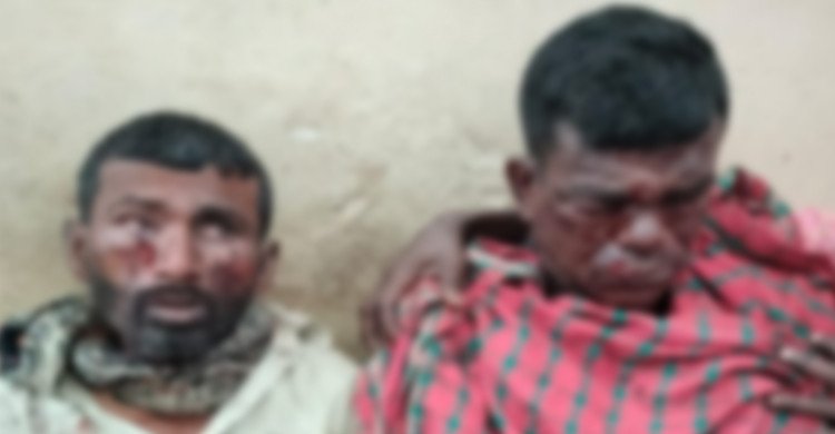 মাটির নিচে পুঁতে রাখা বোমা বিস্ফোরণে দুই শ্রমিক আহত