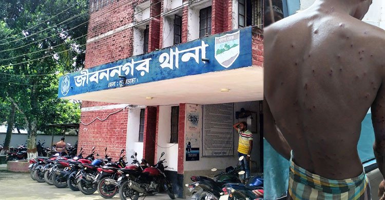চুয়াডাঙ্গা সীমান্তে বিএসএফের গুলিতে বাংলাদেশী আহত 