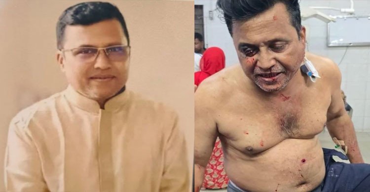 কুষ্টিয়ায় কার্যক্রম নিষিদ্ধ আ. লীগ নেতা গুলিবিদ্ধ 