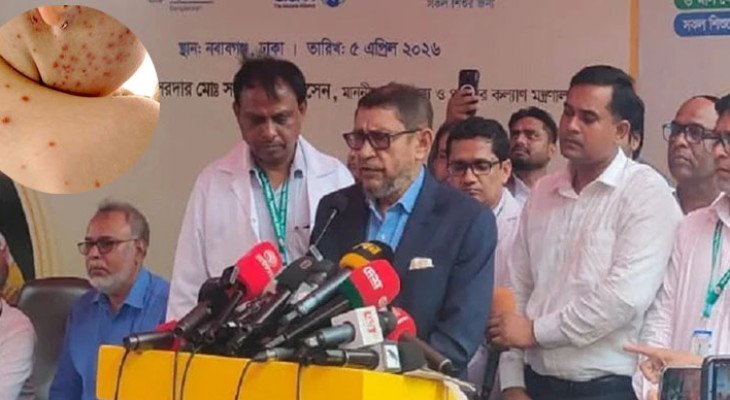 আগামী ৩ মে থেকে সারা দেশে মিলবে হামের টিকা: স্বাস্থ্যমন্ত্রী