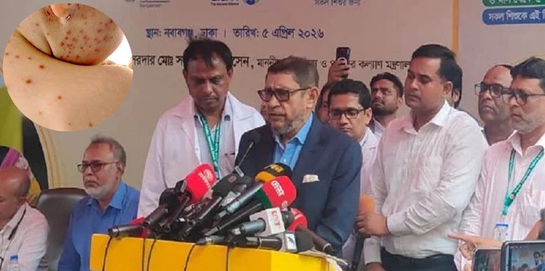 আগামী ৩ মে থেকে সারা দেশে মিলবে হামের টিকা: স্বাস্থ্যমন্ত্রী
