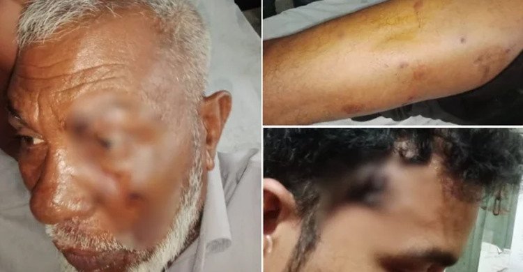 পদ্মা নদীতে টহলরত নৌ পুলিশের ওপর হামলা, গুলিবিদ্ধ ওসিসহ ৫ সদস্য