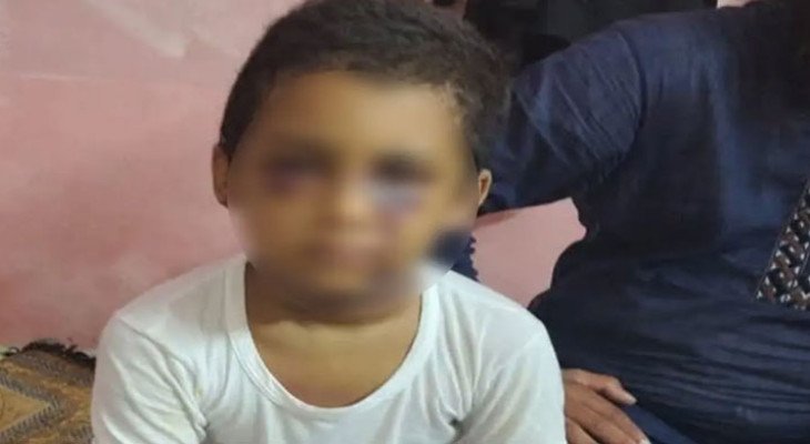 খুলনায় শিক্ষকের মারধরে শিশুর ‘মস্তিষ্কে জমাট বেঁধেছে রক্ত’