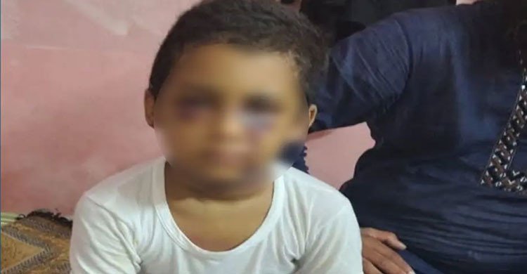 খুলনায় শিক্ষকের মারধরে শিশুর ‘মস্তিষ্কে জমাট বেঁধেছে রক্ত’