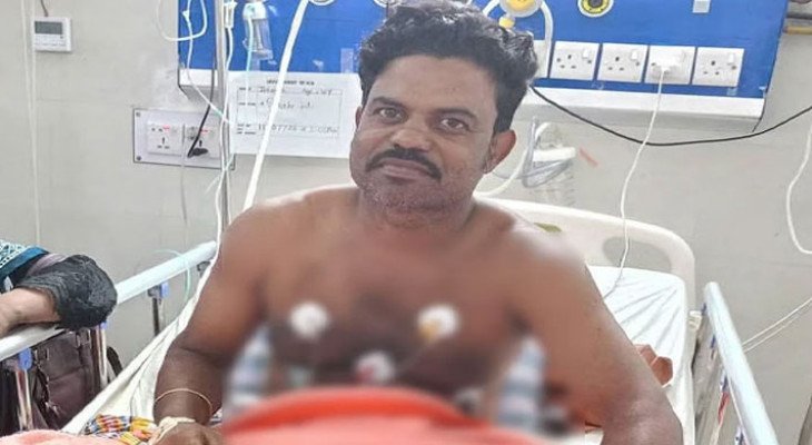 কুষ্টিয়ায় সাপের কামড় খেয়ে নিজেই হাসপাতালে চিকিৎসা নিচ্ছেন ‘বিষঝাড়া ওঝা’  