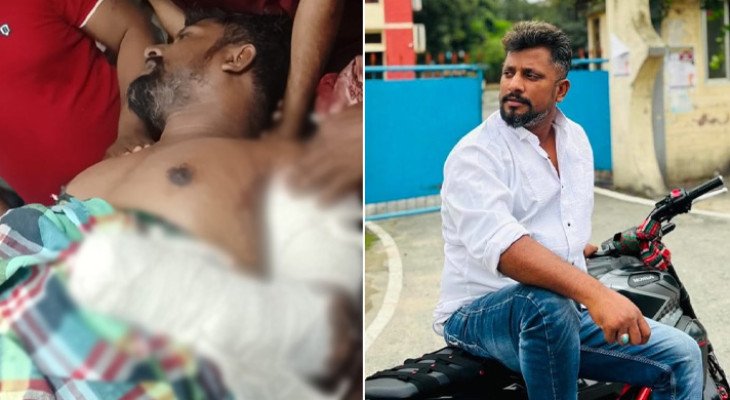চুয়াডাঙ্গায় সাবেক যুবদল নেতাকে কুপিয়ে জখম, বিচ্ছিন্ন এক হাতের কবজি