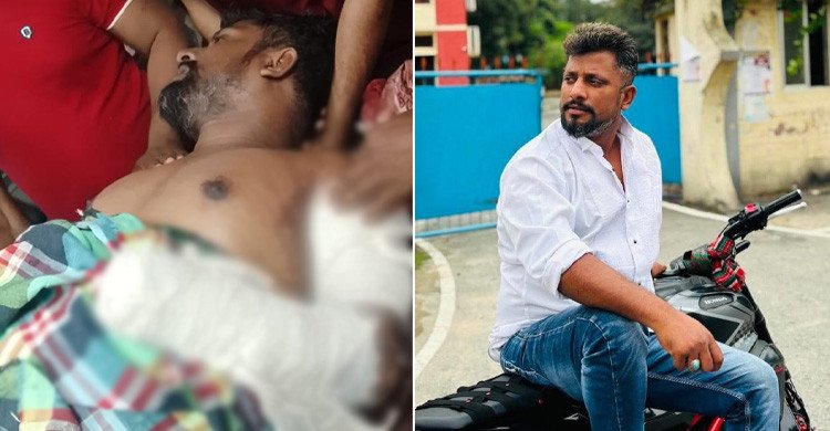 চুয়াডাঙ্গায় সাবেক যুবদল নেতাকে কুপিয়ে জখম, বিচ্ছিন্ন এক হাতের কবজি