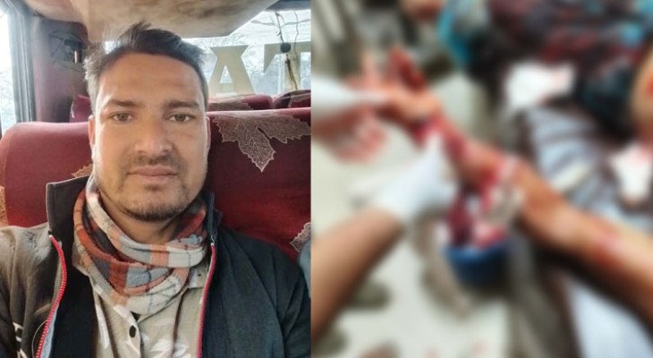 নওগাঁয় যুবদল নেতার হাতের কব্জি কেটে দেওয়ার অভিযোগ আ.লীগ নেতার বিরুদ্ধে