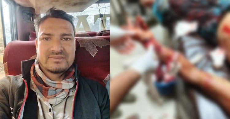 নওগাঁয় যুবদল নেতার হাতের কব্জি কেটে দেওয়ার অভিযোগ আ.লীগ নেতার বিরুদ্ধে