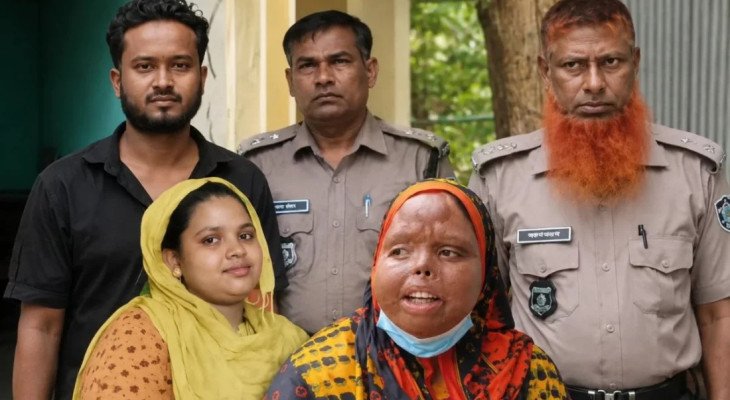 গরম ডাল ছুড়ে স্ত্রীর মুখ ঝলসানোর পর তালাক, মামলায় কারাগারে স্বামী