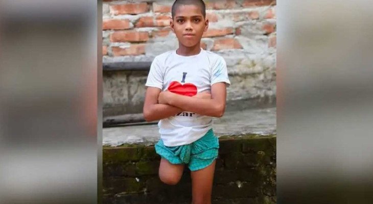 চুল কাটতে বেরিয়ে ৭ মাস পর এক পা ও কিডনি হারিয়ে ফিরল রায়হান