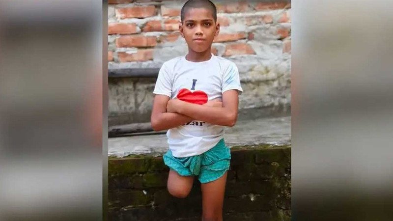 চুল কাটতে বেরিয়ে ৭ মাস পর এক পা ও কিডনি হারিয়ে ফিরল রায়হান