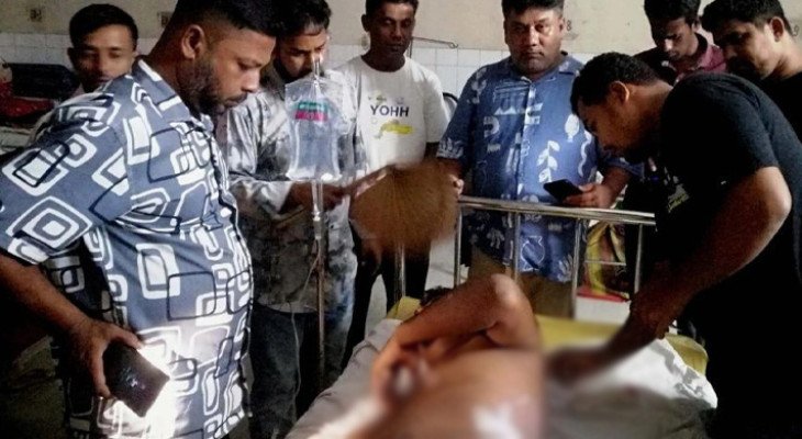 ছাত্রদল নেতার শরীরে ফুটন্ত পানি ঢেলে ঝলসে দিল আ. লীগ নেতার ছেলে